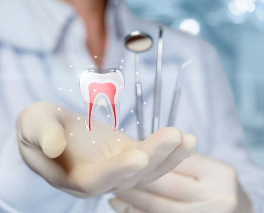 WHAT IS ROOT CANAL TREATMENT? દાંતની મૂળિયા સુધી સફાઈ અને સારવાર શું છે?