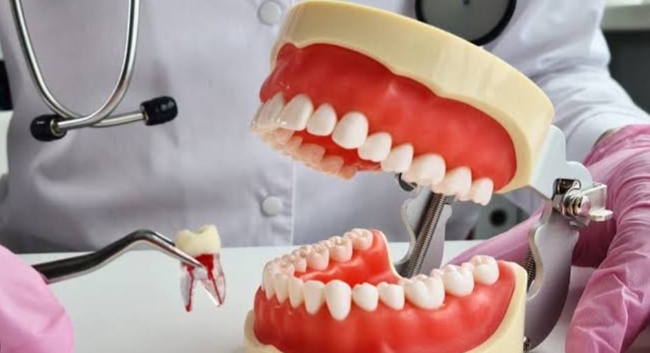 WHY WE NEED TO DO DENTAL EXTRACTION/TOOTH REMOVAL?દાંત કાઢવાની જરૂર શા માટે પડે છે?
