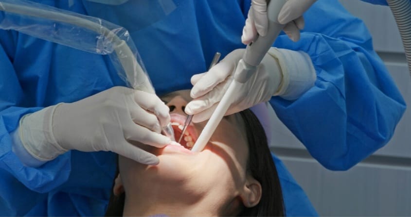 WHY WE NEED TO DO TEETH CLEANING? દાંતની સફાઈ જરૂર શા માટે પડે છે?